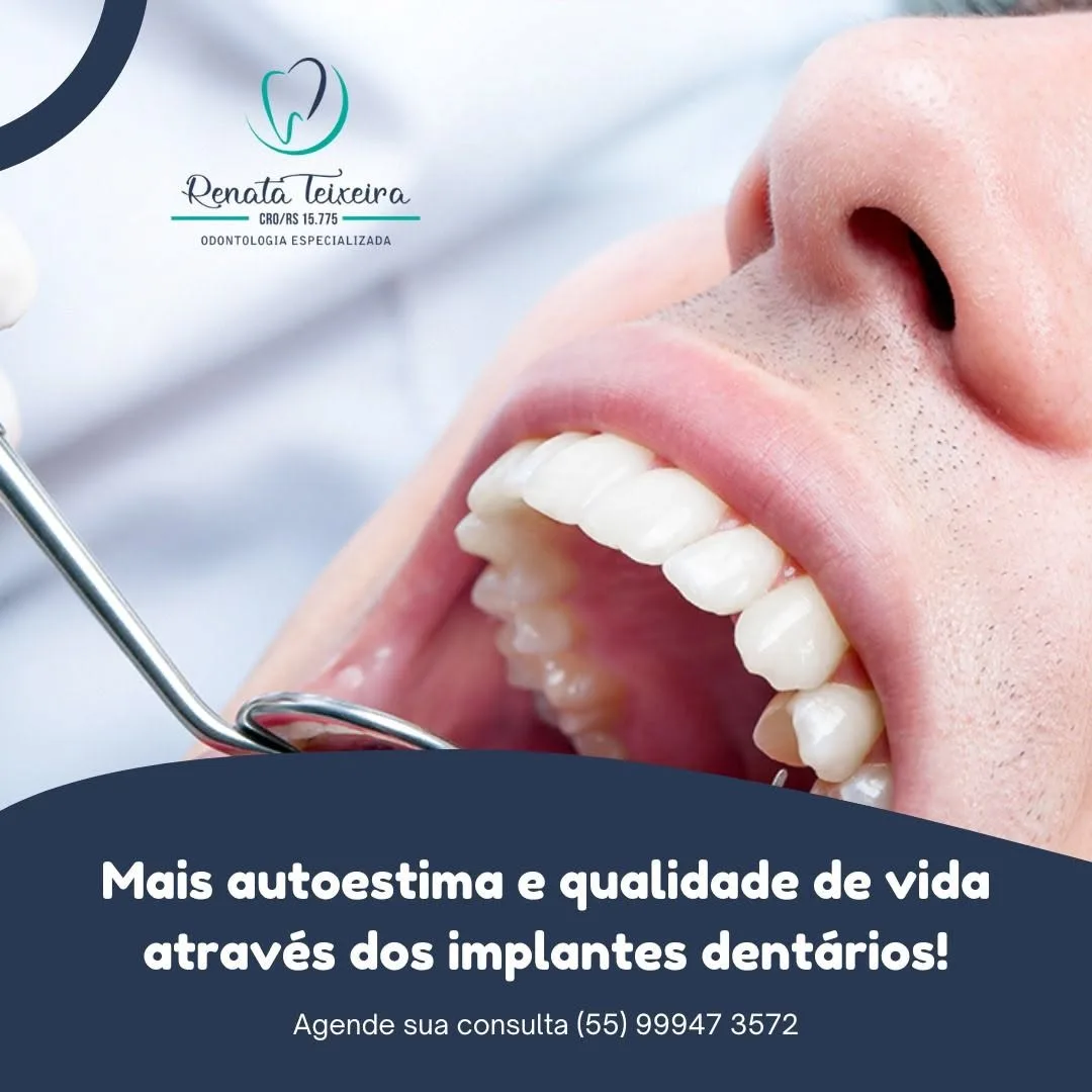 Implante Dentário